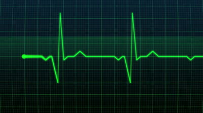 Heart Rate Based Remote Collateral System using Mobile Communication